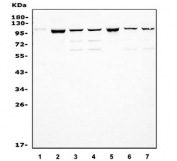 Western blot testing of 1) human SH-SY5Y, 2) human HEK293, 3) rat brain, 4) rat brain, 5) rat C6, 6) mouse brain and 7) mouse brain lysate with KCNQ2 antibody. Predicted molecular weight ~96 kDa.
