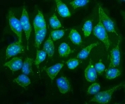 Immunofluorescent staining of FFPE human HeLa cells with p38 gamma antibody (green) and DAPI nuclear stain (blue). HIER: steam section in pH6 citrate buffer for 20 min.