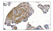 IHC staining of FFPE human placental tissue with MerTK antibody. HIER: boil tissue sections in pH8 EDTA for 20 min and allow to cool before testing.