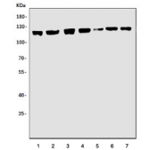 Western blot testing of 1) human HepG2, 2) human Jurkat, 3) human Caco-2, 4) rat testis, 5) rat lung, 6) mouse testis and 7) mouse lung lysate with MerTK antibody. Expected molecular weight: 110~205 kDa depending on glycosylation level.