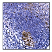 IHC staining of FFPE human tonsil tissue with Ki67 antibody. HIER: boil tissue sections in pH8 EDTA for 20 min and allow to cool before testing.