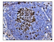IHC staining of FFPE rat lymph tissue with Ki67 antibody. HIER: boil tissue sections in pH8 EDTA for 20 min and allow to cool before testing.