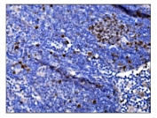 IHC staining of FFPE mouse lymph tissue with Ki67 antibody. HIER: boil tissue sections in pH8 EDTA for 20 min and allow to cool before testing.