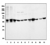 Western blot testing of human 1) K562, 2) A431, 3) HEK293, 4) Caco-2, 5) U-87 MG, 6) HepG2, 7) U-2 OS, 8) rat kidney, 9) rat testis, 10) mouse brain and 11) mouse kidney lysate with Ornithine Aminotransferase antibody. Predicted molecular weight ~49 kDa.