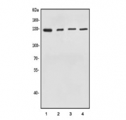 Western blot testing of 1) human HEK293, 2) human HeLa, 3) rat brain and 4) mouse brain lysate with O-GlcNAcase antibody. Predicted molecular weight ~103 kDa, routinely observed at ~130 kDa (cytoplasmic form) and ~75 kDa (nuclear form).
