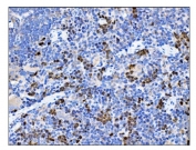 IHC staining of FFPE rat spleen tissue with O-GlcNAcase antibody. HIER: boil tissue sections in pH8 EDTA for 20 min and allow to cool before testing.