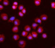 Immunofluorescent staining of FFPE human T-47D cells with O-GlcNAcase antibody (red) and DAPI nuclear stain (blue). HIER: steam section in pH6 citrate buffer for 20 min.