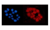 Immunofluorescent staining of FFPE human MCF-7 cells with ORC5L antibody (red) and DAPI nuclear stain (blue). HIER: steam section in pH6 citrate buffer for 20 min.