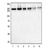 Western blot testing of 1) human HeLa, 2) human HEK293, 3) rat stomach, 4) rat pancreas, 5) mouse stomach and 6) mouse pancreas lysate with PSD5A antibody. Predicted molecular weight ~151 kDa.