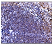 IHC staining of FFPE human tonsil tissue with Prolyl Endopeptidase antibody. HIER: boil tissue sections in pH8 EDTA for 20 min and allow to cool before testing.