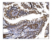 IHC staining of FFPE rat intestinal tissue with Prolyl Endopeptidase antibody. HIER: boil tissue sections in pH8 EDTA for 20 min and allow to cool before testing.