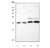 Western blot testing of 1) human HepG2, 2) human MCF7, 3) rat liver and 4) mouse liver tissue lysate with Psmb1 antibody. Predicted molecular weight ~26 kDa.