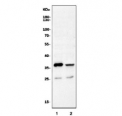 Western blot testing of 1) rat hippocampus and 2) mouse hippocampus tissue lysate with SCN1B antibody. Predicted molecular weight: 24-30 kDa but commonly observed at 30-40 kDa.