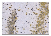 IHC staining of FFPE rat brain tissue with SCN1B antibody. HIER: boil tissue sections in pH8 EDTA for 20 min and allow to cool before testing.
