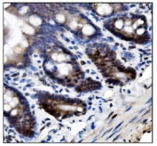 IHC staining of FFPE rat intestine tissue with SUMO2/3 antibody. HIER: boil tissue sections in pH8 EDTA for 20 min and allow to cool before testing.