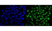 Immunofluorescent staining of FFPE human A431 cells with SUMO2/3 antibody (green) and DAPI nuclear stain (blue). HIER: steam section in pH6 citrate buffer for 20 min.