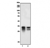 Western blot testing of 1) mouse lung and 2) mouse kidney tissue lysate with Superoxide dismutase 3 antibody. Predicted molecular weight: 26~32 kDa.