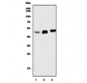 Western blot testing of human 1) COLO-320, 2) PC-3 and 3) A431 cell lysate with SOX7 antibody. Predicted molecular weight: 42/49 kDa (isoforms 1/2).