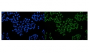 Immunofluorescent staining of FFPE human MCF7 cells with SRF antibody (green) and DAPI nuclear stain (blue). HIER: steam section in pH6 citrate buffer for 20 min.