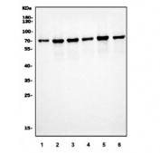 Western blot testing of human 1) HeLa, 2) HEK293, 3) MCF7, 4) HepG2, 5) Jurkat and 6) Caco-2 cell lysate with SRF antibody. Predicted molecular weight: ~52/60-70 kDa (unmodified/phosphorylated).