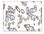 IHC staining of FFPE human placental tissue with TRAP alpha antibody. HIER: boil tissue sections in pH8 EDTA for 20 min and allow to cool before testing.