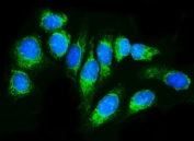 Immunofluorescent staining of FFPE human U-2 OS cells with TRAP alpha antibody (green) and DAPI nuclear stain (blue). HIER: steam section in pH6 citrate buffer for 20 min.