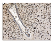 IHC staining of FFPE mouse brain tissue with TRAP alpha antibody. HIER: boil tissue sections in pH8 EDTA for 20 min and allow to cool before testing.
