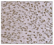 IHC staining of FFPE rat brain tissue with TRAP alpha antibody. HIER: boil tissue sections in pH8 EDTA for 20 min and allow to cool before testing.