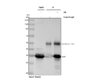 Immunoprecipitation of TRAP alpha protein from 500ug of human HepG2 whole cell lysate with 2ug of TRAP alpha antibody.