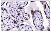 IHC staining of FFPE human placental tissue with KMT1B antibody. HIER: boil tissue sections in pH8 EDTA for 20 min and allow to cool before testing.