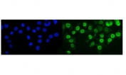 Immunofluorescent staining of FFPE human Caco-2 cells with KMT1B antibody (green) and DAPI nuclear stain (blue). HIER: steam section in pH6 citrate buffer for 20 min.