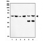 Western blot testing of 1) human SW620, 2) human MCF7, 3) human HeLa, 4) human Caco-2, 5) rat liver and 6) mouse liver lysate with KMT1B antibody. Expected molecular weight: 40-53 kDa.