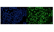 Immunofluorescent staining of FFPE human A431 cells with Ki-67 antibody (green) and DAPI nuclear stain (blue). HIER: steam section in pH6 citrate buffer for 20 min.