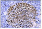 IHC staining of FFPE human tonsil tissue with Ki-67 antibody. HIER: boil tissue sections in pH8 EDTA for 20 min and allow to cool before testing.