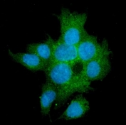 Immunofluorescent staining of FFPE human HepG2 cells with TGF beta Receptor II antibody (green) and DAPI nuclear stain (blue). HIER: steam section in pH6 citrate buffer for 20 min.