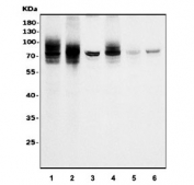 Western blot testing of human 1) HepG2, 2) A549, 3) K562, 4) Caco-2, 5) HeLa and 6) T-47D cell lysate with TGF beta Receptor II antibody. Expected molecular weight ~65 kDa, routinely observed at 65-80 kDa.