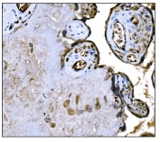 IHC staining of FFPE human placental tissue with M6PR antibody. HIER: boil tissue sections in pH8 EDTA for 20 min and allow to cool before testing.