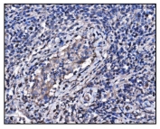 IHC staining of FFPE human testis cancer tissue with HSP90AA1 antibody. HIER: boil tissue sections in pH8 EDTA for 20 min and allow to cool before testing.