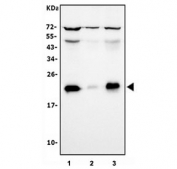 Western blot testing of human 1) HEK293, 2) HeLa and 3) K562 cell lysate with RPL13A antibody. Predicted molecular weight ~23 kDa.
