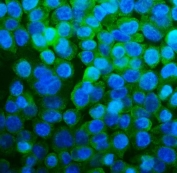 Immunofluorescent staining of FFPE human Caco-2 cells with RPL13A antibody (green) and DAPI nuclear stain (blue). HIER: steam section in pH6 citrate buffer for 20 min.
