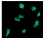 Immunofluorescent staining of FFPE human MCF7 cells with DDX6 antibody (green) and DAPI nuclear stain (blue). HIER: steam section in pH6 citrate buffer for 20 min.