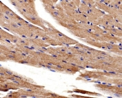IHC staining of FFPE mouse heart tissue with ACTN2 antibody. HIER: boil tissue sections in pH8 EDTA for 20 min and allow to cool before testing.