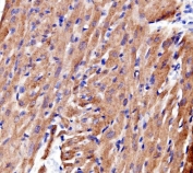 IHC staining of FFPE rat heart tissue with ACTN2 antibody. HIER: boil tissue sections in pH8 EDTA for 20 min and allow to cool before testing.