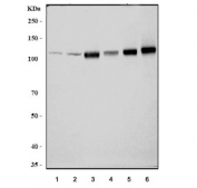 Western blot testing of 1) human HeLa, 2) human HepG2, 3) rat skeletal muscle, 4) rat heart, 5) mouse skeletal muscle and 6) mouse heart lysate with ACTN2 antibody. Predicted molecular weight ~103 kDa.