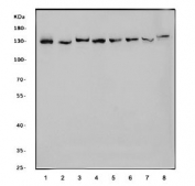 Western blot testing of 1) human Jurkat, 2) monkey COS-7, 3) human RT4, 4) human K562, 5) human HEL, 6) rat brain, 7) mouse brain and 8) mouse NIH 3T3 cell lysate with CCAR2 antibody. Expected molecular weight: 103-140 kDa depending on level of acetylation.
