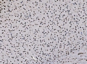 IHC staining of FFPE mouse brain tissue with CCAR2 antibody. HIER: boil tissue sections in pH8 EDTA for 20 min and allow to cool before testing.