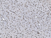 IHC staining of FFPE rat brain tissue with CCAR2 antibody. HIER: boil tissue sections in pH8 EDTA for 20 min and allow to cool before testing.