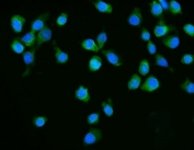 Immunofluorescent staining of FFPE human MCF7 cells with Dicer antibody (green) and DAPI nuclear stain (blue). HIER: steam section in pH6 citrate buffer for 20 min.