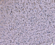 IHC staining of FFPE mouse brain tissue with DLAT antibody. HIER: boil tissue sections in pH8 EDTA for 20 min and allow to cool before testing.