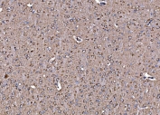 IHC staining of FFPE rat brain tissue with DLAT antibody. HIER: boil tissue sections in pH8 EDTA for 20 min and allow to cool before testing.